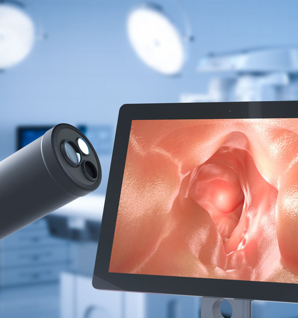 exame-endoscopia-Digestiva-Alta-procologista-centro-medico-belem-3